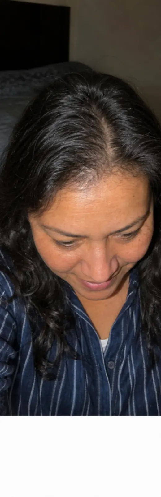 Carmen S., después de 5 meses de uso